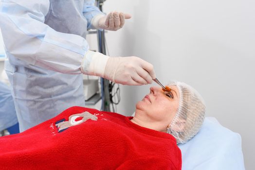 Blepharoplasty, plastic surgery operation for correcting defects, deformities, and disfigurations of the eyelids.