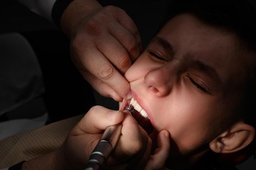 A visit to the dentist, brushing a tooth with a drill, a schoolboy at a pediatric dentist, fear and pain when drilling a tooth.