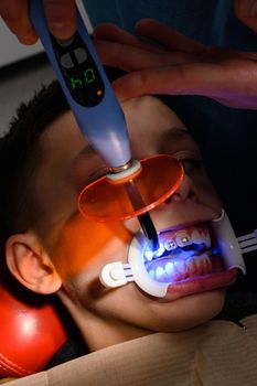 Alignment of crooked teeth with the help of braces, installation of braces for a child, an orthodontist glues metal plates braces for teeth alignment, ultraviolet for quick drying of the glue.