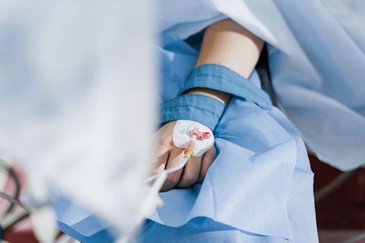 Catheter medical device for anesthesia for surgical operation