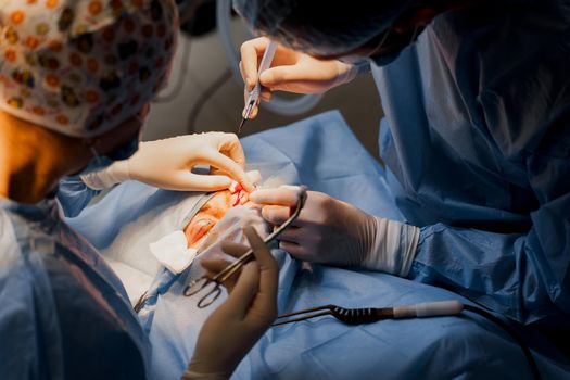 Blepharoplasty plastic surgery operation for modifying the eye region of the face in medical clinic. Surgeon makes an incision with a surgical knife