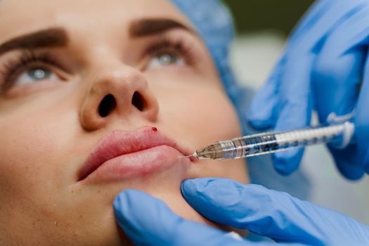 Close-up lips augmentation injections for attractive girl. Plastic surgeon does injection in lip in medical clinic. Cosmetic rejuvenating facial treatment.