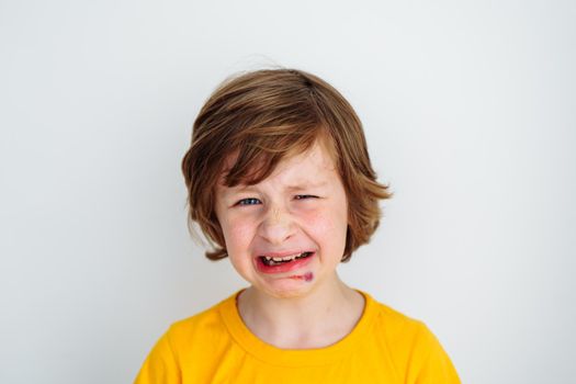 Portrait of school boy kid child crying due to sore bruised wound on his face. Caucasian schoolboy in yellow t-shirt crying of pain as he hurt his face on white background with copy space for text.