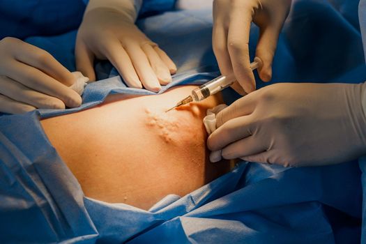 Close-up anesthesia thigh injection before blepharoplasty and lipofilling plastic surgery operation for modifying the eye region of the face