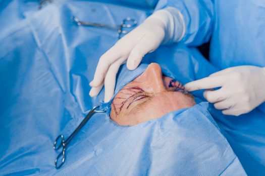 Close-up anesthesia before blepharoplasty and lipofilling plastic surgery operation for modifying the eye region of the face in medical clinic