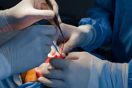 Upper blepharoplasty. Surgeon do plastic operation. 2 surgeons removing piece of skin from eyelid. Transconjunctival blepharoplasty. Surgery.