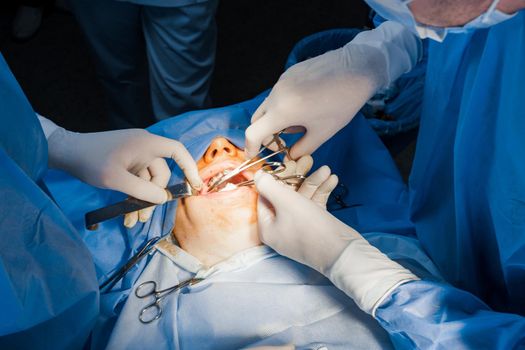 Buccal fat removal. Bisha lumps removal. Plastic surgery in clinic. Plastic surgery operation for modifying face in medical clinic.