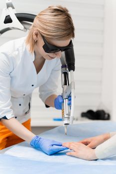 Laser treatment of onychomycosis. fungal infection on the hands of a young girl in medical clinic.