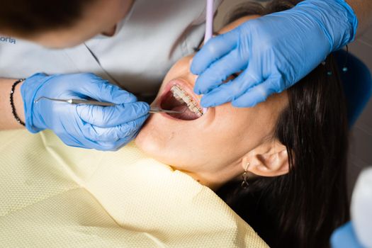 Teeth straightening braces stomatology procedure. Dentist removes brackets