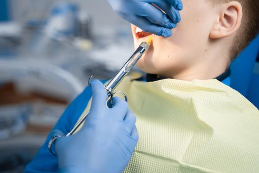 Dentist injects anesthesia syringe of the diseased teeth for the patient. Caries treatment