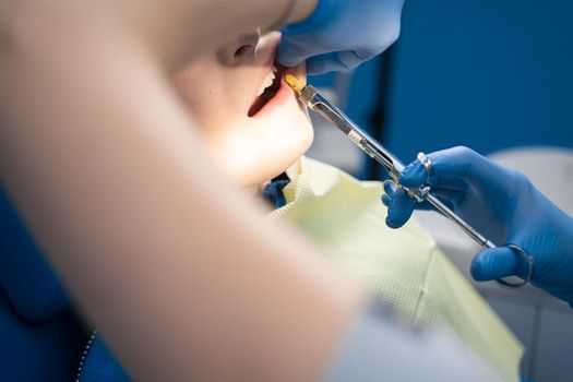 Dentist injects anesthesia syringe of the diseased teeth for the patient. Caries treatment