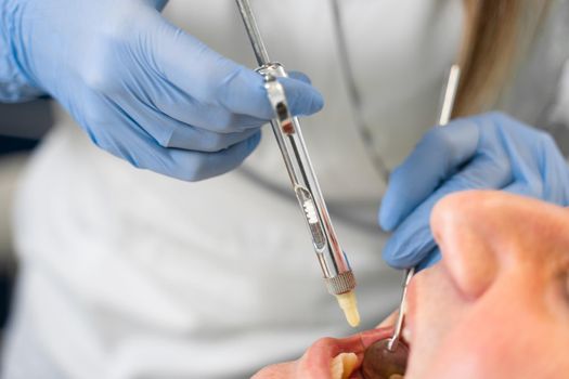 Dentist injects anesthesia syringe of the diseased teeth for the patient. Caries treatment