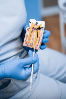 Dummy of a sick tooth with caries, Dentist shows structure of the teeth