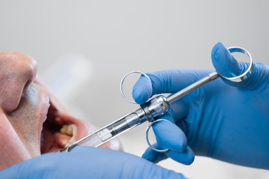 Dentist injects anesthesia syringe of the diseased teeth for the patient. Caries treatment