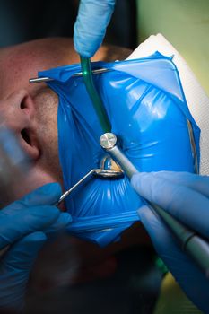 Dental treatment cofferdam in stomatology. Dentist using dental dam for tooth isolation