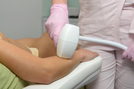 Laser hair removal procedure on ladies hand