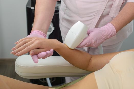 Laser hair removal procedure on ladies hand