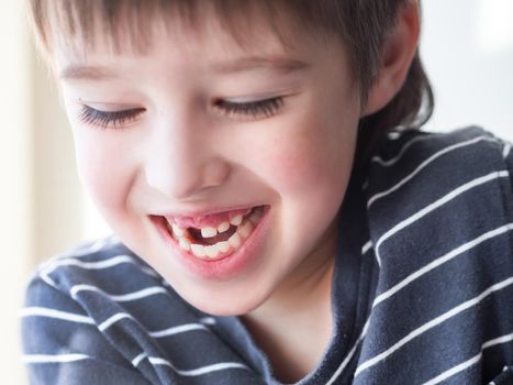 Shyly smiling kid shows hole in row of teeth in his mouth. One incisor fell out just now. Close up photo of gums for dentist.