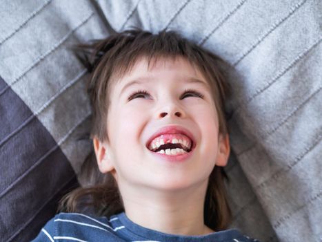 Laughing kid shows hole in row of teeth in his mouth. One incisor fell out just now. Close up photo of gums for dentist.