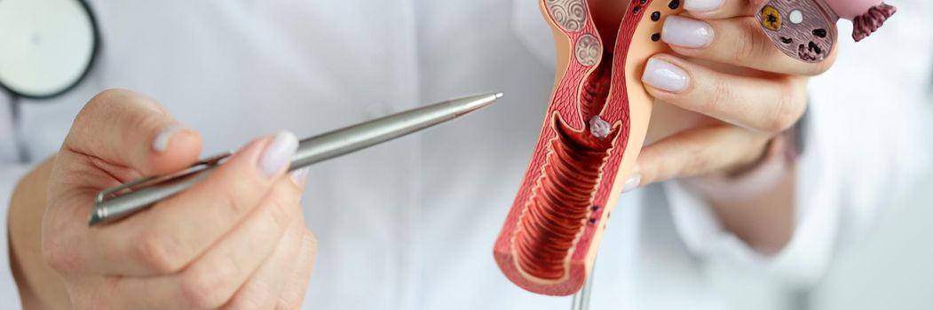 Doctor gynecologist showing pen on plastic model of uterus and ovaries closeup. Diagnostics and treatment of gynecological diseases concept