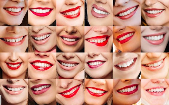 Collage of differents female smiling at camera with tooth, after beauty salon, with red lips and perfect makeup. Womens perfect smile after dental and clinic procedure. Colors of lipstick.