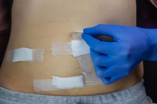 Examination of the patient by a doctor after removal of the appendix