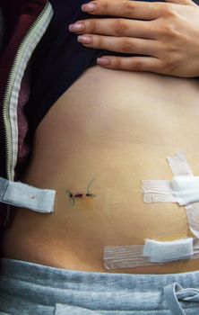 Examination of the patient by a doctor after removal of the appendix