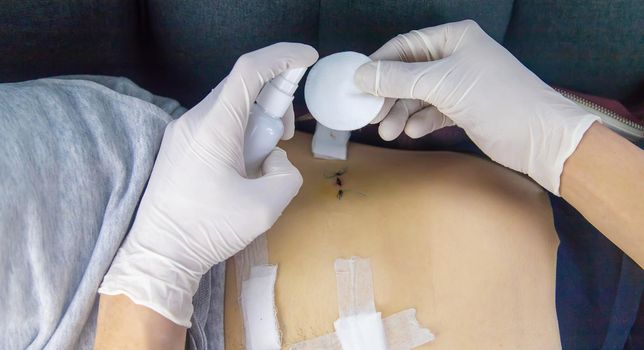Examination of the patient by a doctor after removal of the appendix