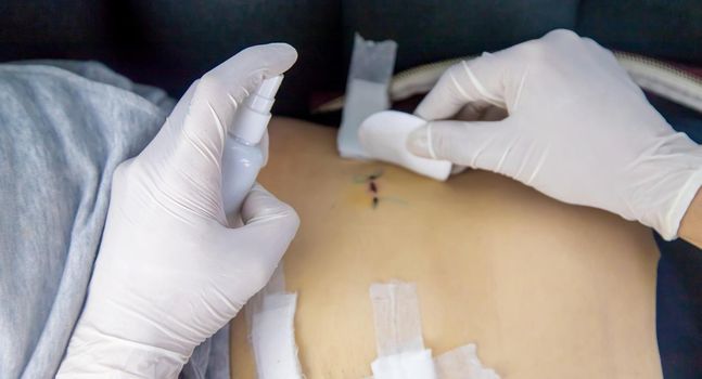 Examination of the patient by a doctor after removal of the appendix