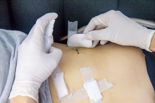 Examination of the patient by a doctor after removal of the appendix