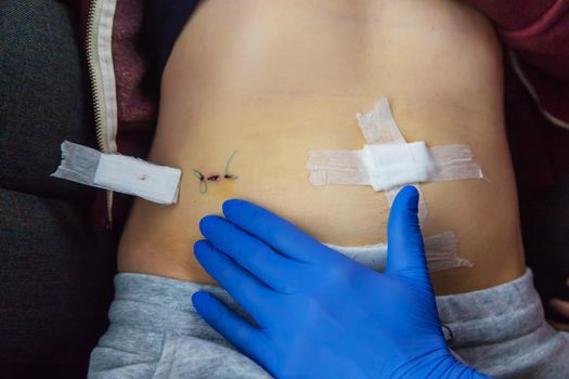 Examination of the patient by a doctor after removal of the appendix