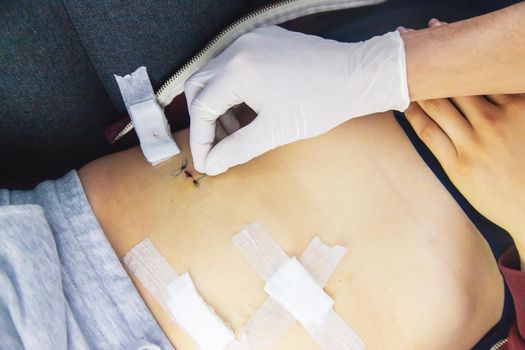 Examination of the patient by a doctor after removal of the appendix