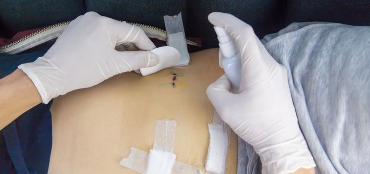 Examination of the patient by a doctor after removal of the appendix