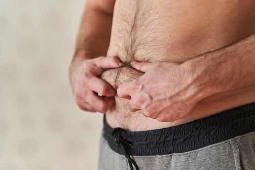 excess fat on the stomach of a young man. young caucasian man grabbing the fat of his hairy stomach. belly fat, weight loss, overweight