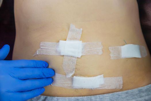 Examination of the patient by a doctor after removal of the appendix