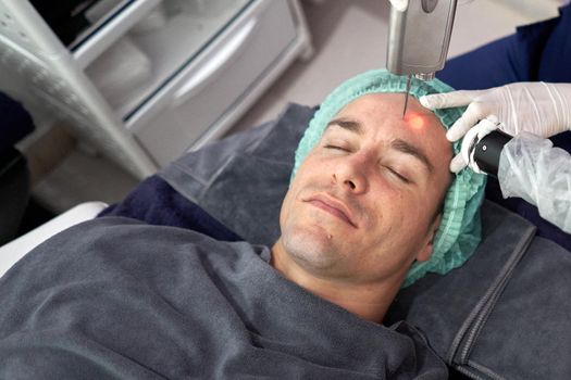 Top view of the face of a relaxed man receiving a laser treatment to rejuvenate the skin of the face