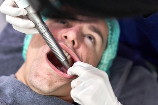 Close up and top view of the face of a patient getting a intraoral facial rejuvenation treatment