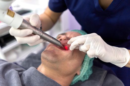 Doctor's hands pulling a man's lip apart for an intraoral laser beauty treatment in a clinic
