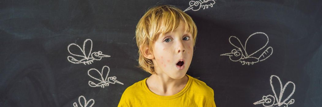 The boy is bitten by mosquitoes on a dark background. On the blackboard with chalk painted mosquitoes. BANNER, LONG FORMAT