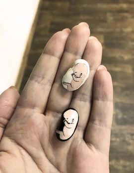 Embryo in woman hand. 8-Weeks Human Embryo