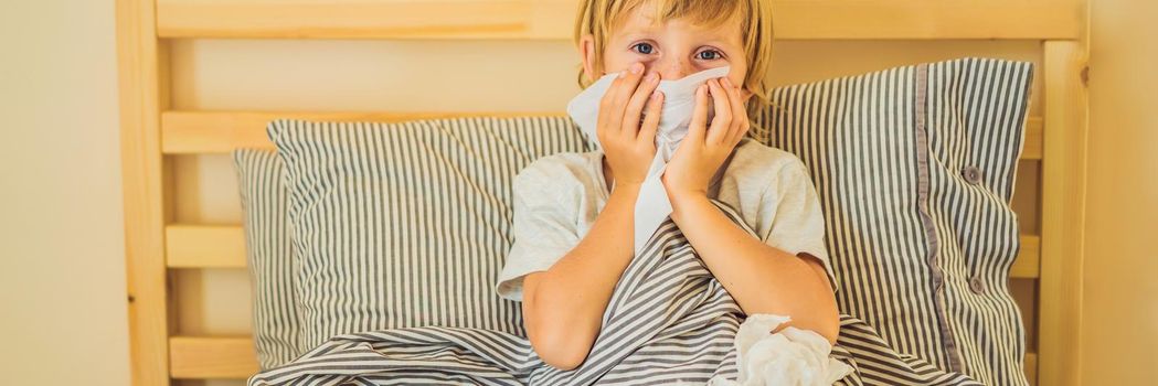 Sick boy coughs and wipes his nose with wipes. Sick child with fever and illness in bed. BANNER, LONG FORMAT