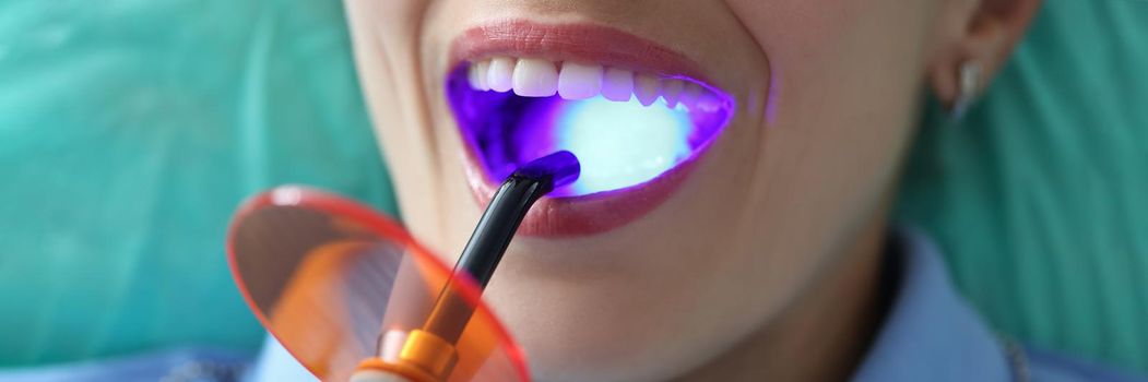 Young woman at the dentist's office, mouth close-up. Sanitation of the oral cavity, examination by a doctor, cleaning of the enamel of the teeth