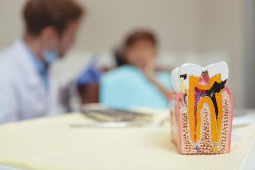 Selective focus on the unhealthy tooth model with caries on the foreground, little boy getting his dental treatment on the back. Dentist curing teeth of a young patient