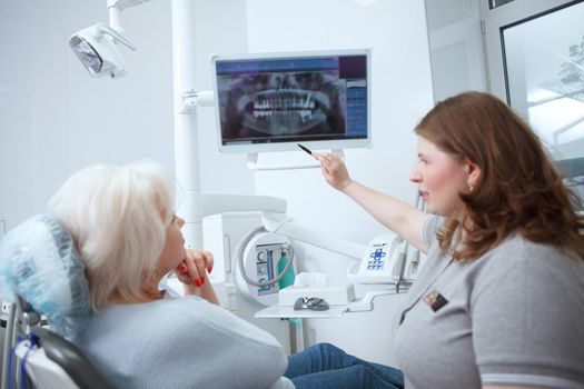 Female dentist showing dental x-ray scan to her senior patient