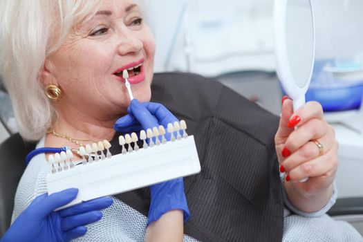 Cropped close up of a senior woman choosing teeth whitening shade at dental clinic