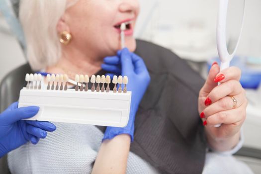 Selective focus on teeth whitening shade chart in the hand of dentist, senior woman looking in the mirror on background