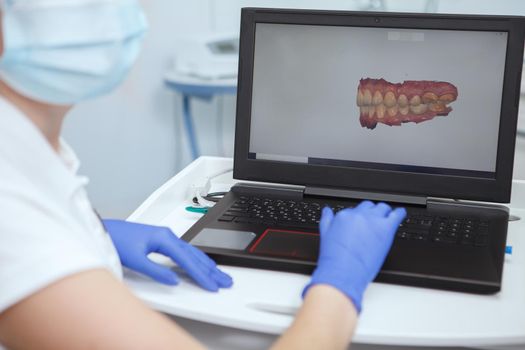 Cropped shot of a dentist examining 3d jaw model on her computer