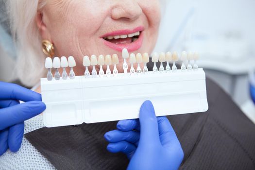 Dentist holding teeth whitening shade guide near teeth of senior female patient