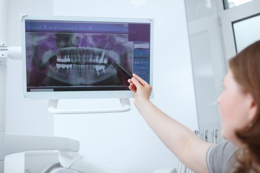 Female dentist examining dental x-ray scan at her clinic
