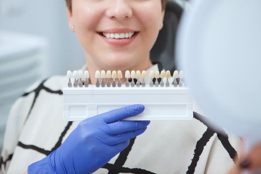 Cropped close up of dentist holding teeth whitening shade guide near patients teeth